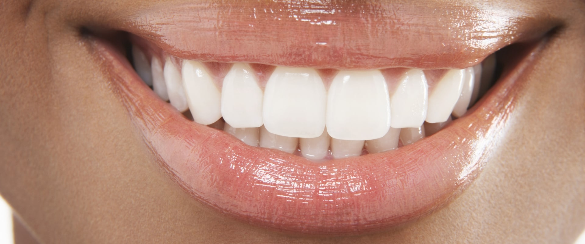 What are the best cosmetic teeth?