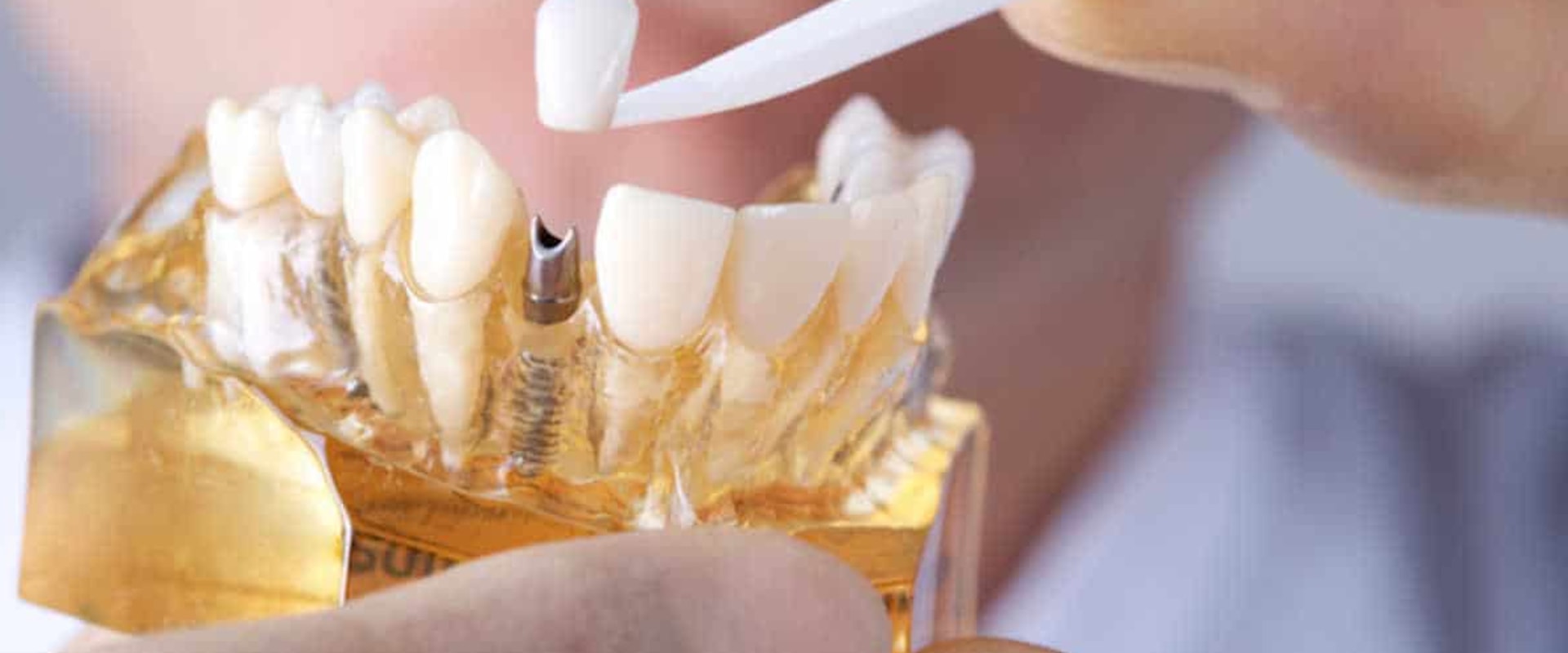 Who is the best cosmetic dentist in Turkey?