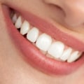 Aesthetic Dentistry: What is Considered Cosmetic in Dental Treatment?