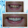 Becoming a Cosmetic Dentist in India: A Comprehensive Guide