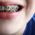 What is the difference between an orthodontist and a cosmetic dentist?
