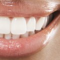 The Best Cosmetic Teeth: A Guide to Achieving the Perfect Smile
