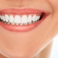 What is classified as cosmetic dentistry?
