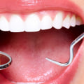 A Comprehensive Guide to Cosmetic Dentistry