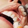 The Most Popular Cosmetic Dentistry Procedures