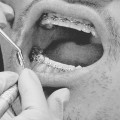 The Difference Between Aesthetic Dentistry and Orthodontics