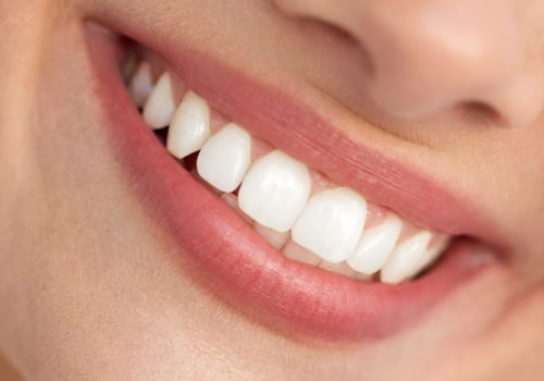 What is considered cosmetic in dental treatment?