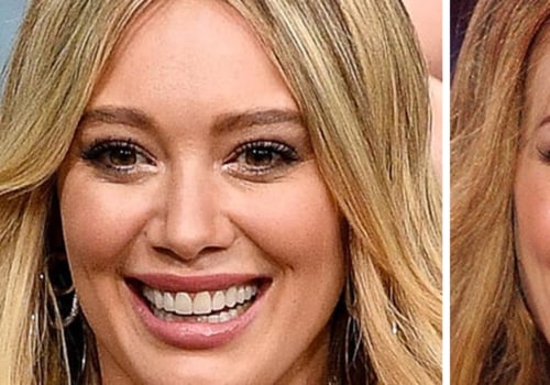 What dental procedures do celebrities use?