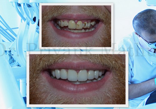 Becoming a Cosmetic Dentist in India: A Comprehensive Guide