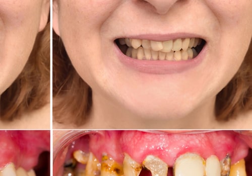 The Best Cosmetic Teeth: A Comprehensive Guide
