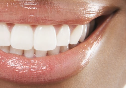 What are the best cosmetic teeth?