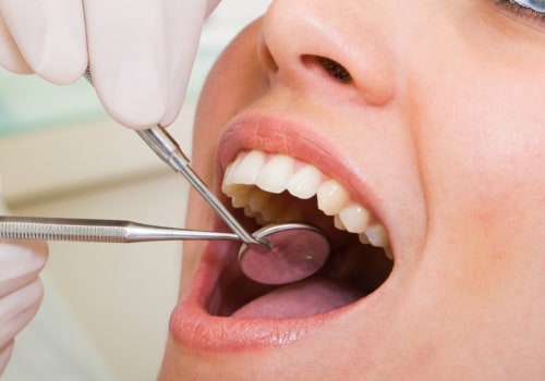 How to Find the Right Cosmetic Dentist