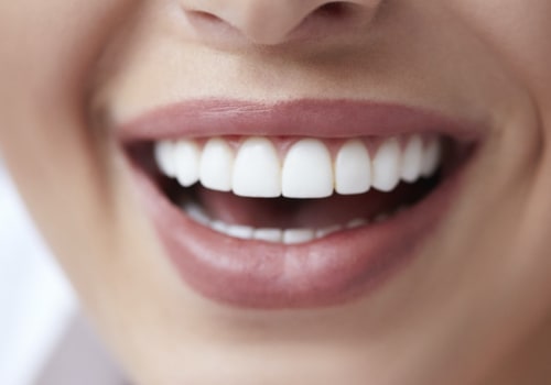Why is cosmetic dentistry popular?