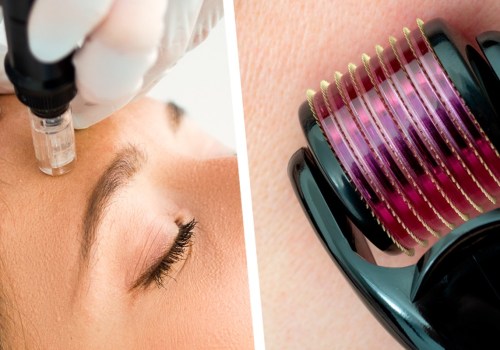 How long do cosmetic devices last?