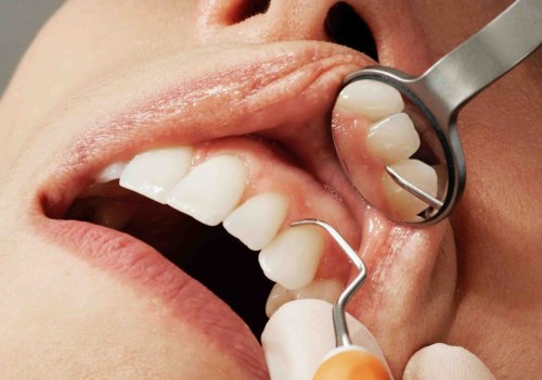 The Most Popular Cosmetic Dentistry Procedures