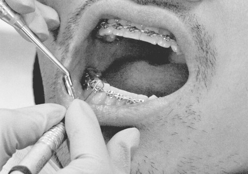 The Difference Between Aesthetic Dentistry and Orthodontics